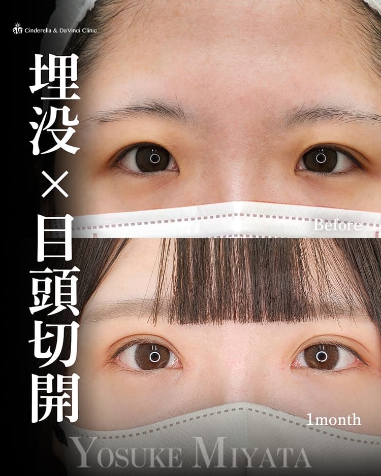 宮田先生の症例