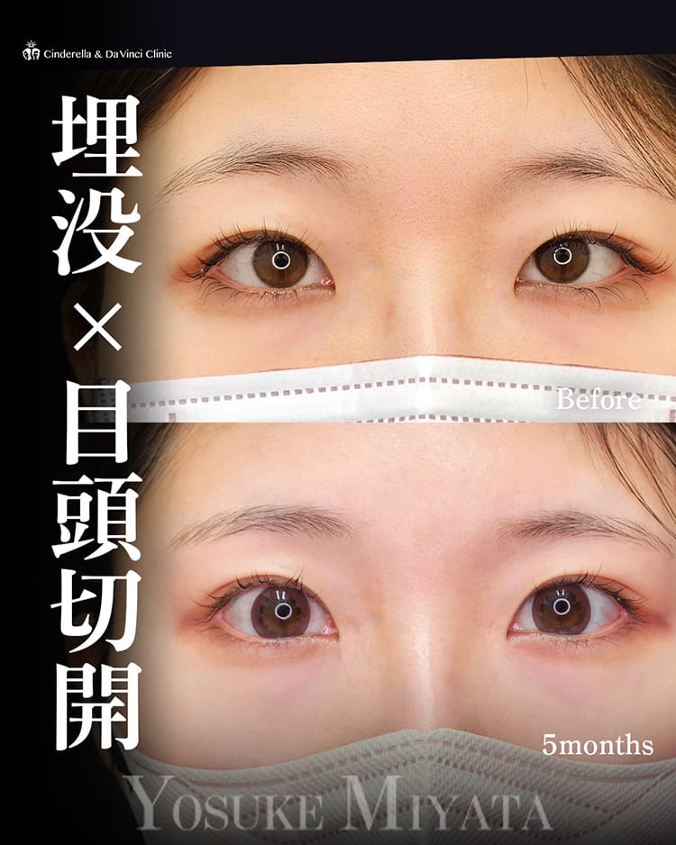 宮田先生の症例