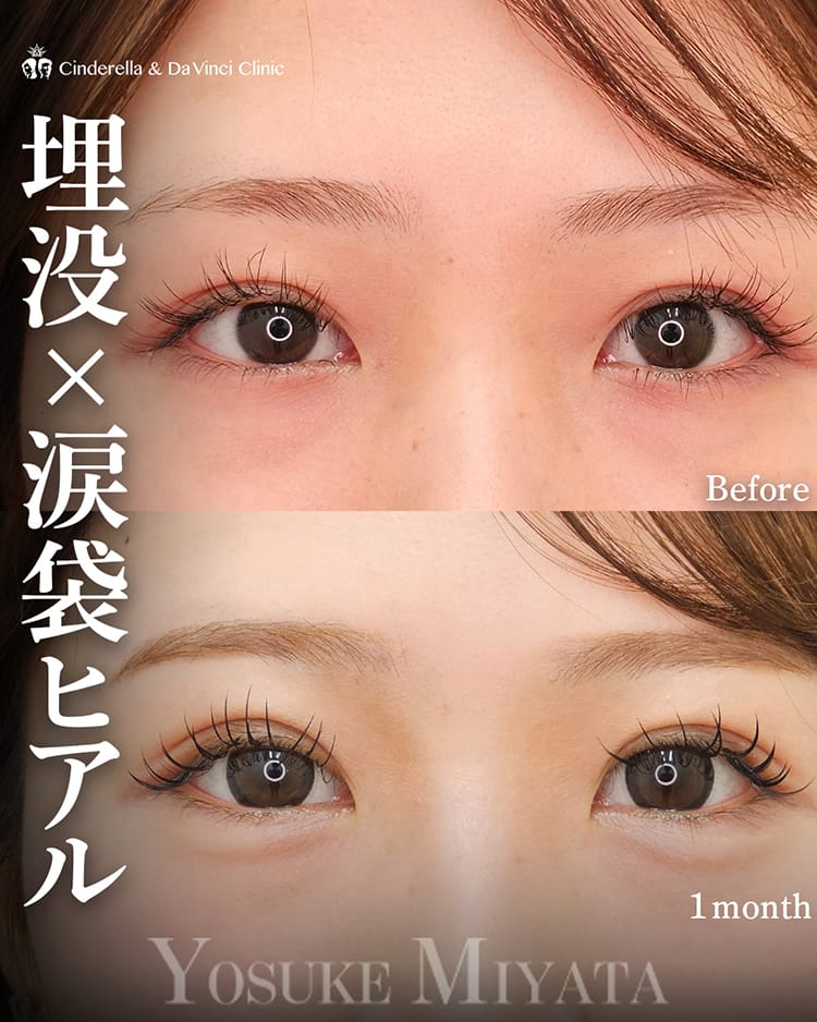 宮田先生の症例