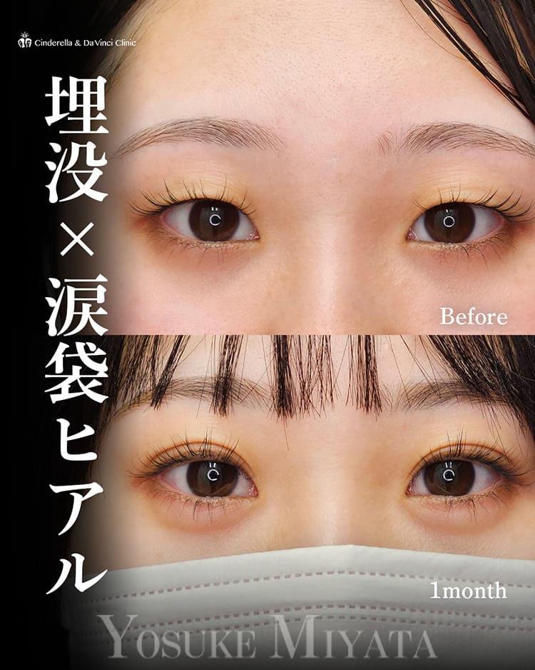 宮田先生の症例