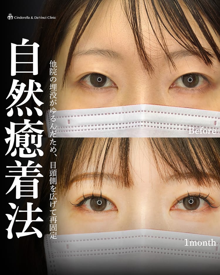 佐藤先生の症例