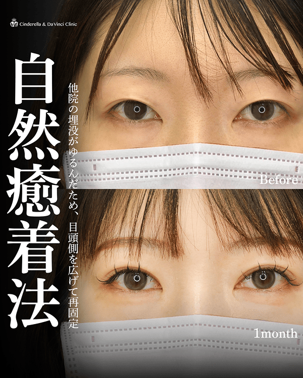 佐藤先生の症例