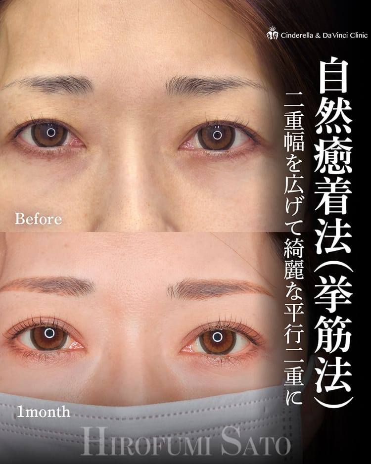 佐藤先生の症例