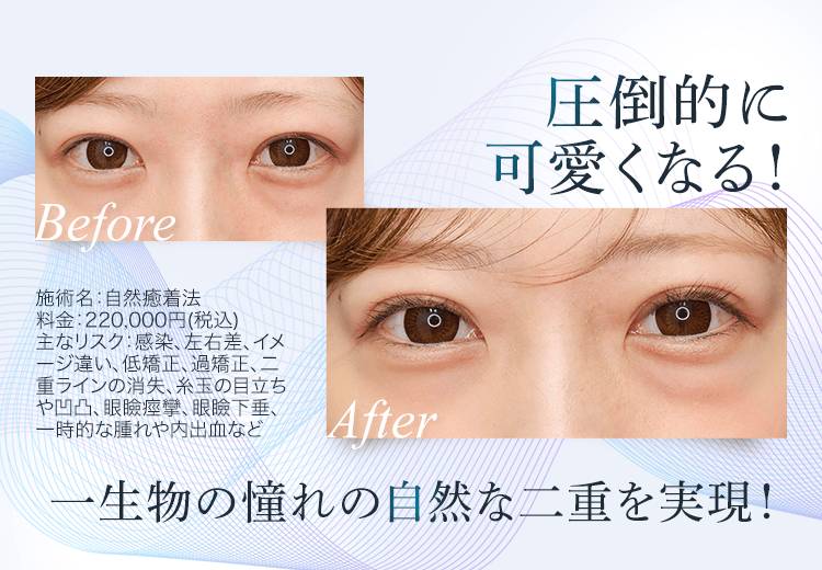 圧倒的に可愛くなる！一生物の憧れの自然な二重を実現！