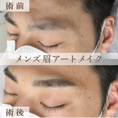 症例写真
