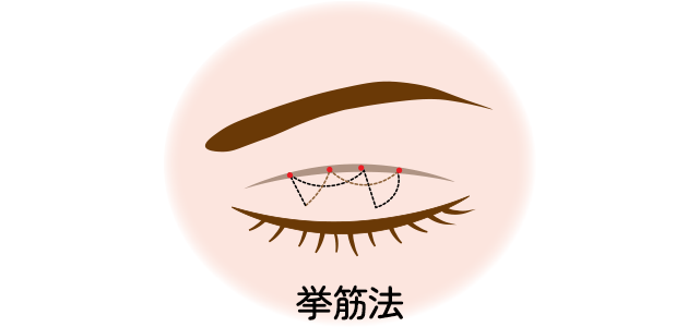 ダブルクロスループ