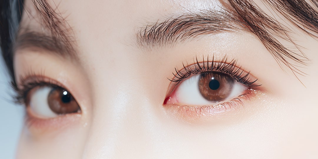 タレ目手術（グラマラスライン形成）