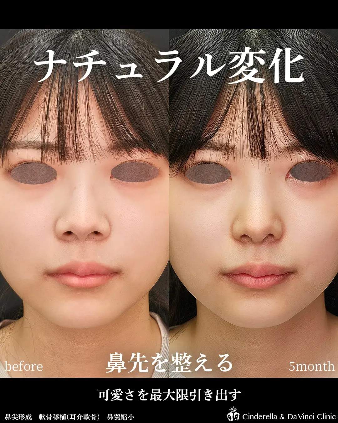 ナチュラル変化