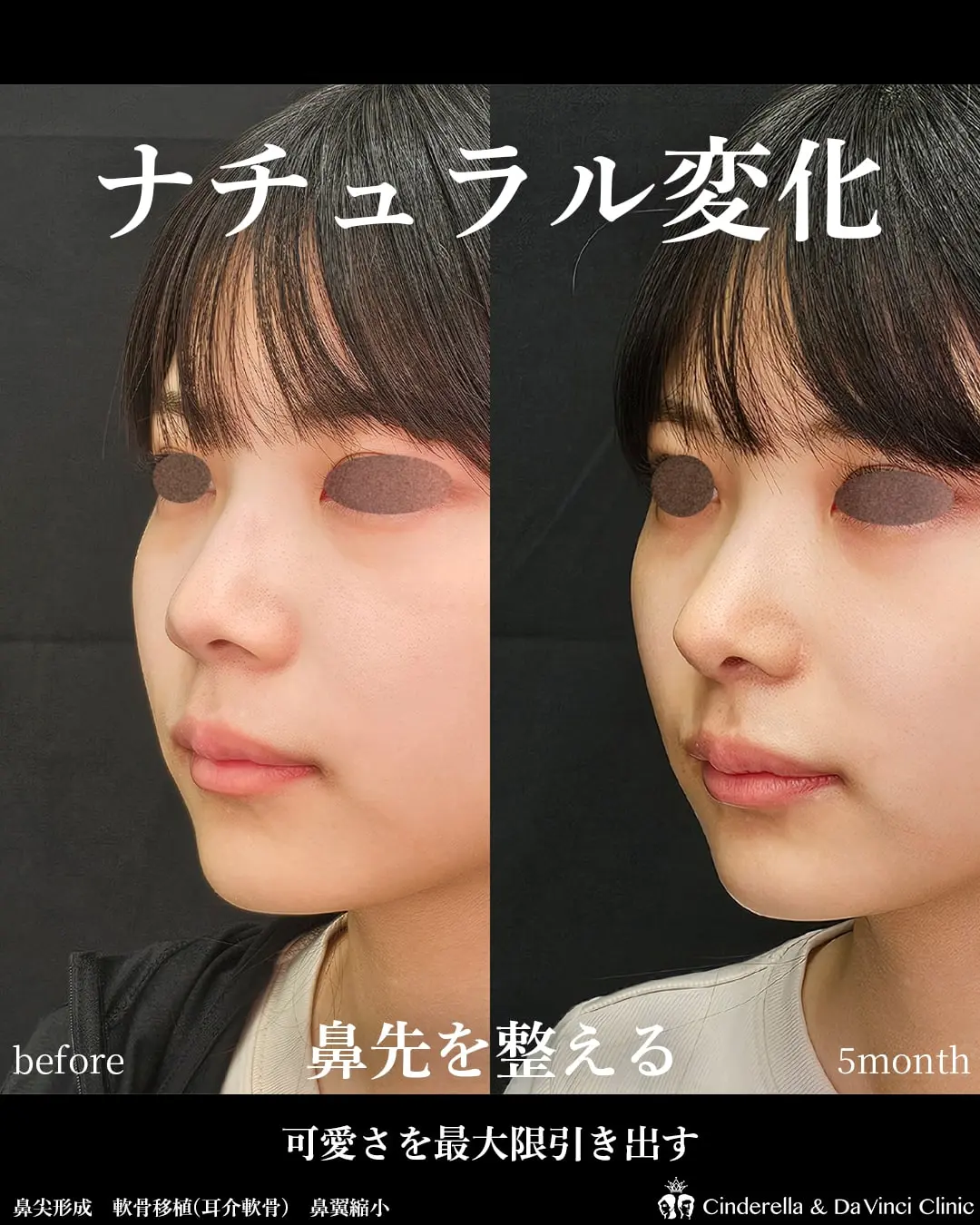 ナチュラル変化