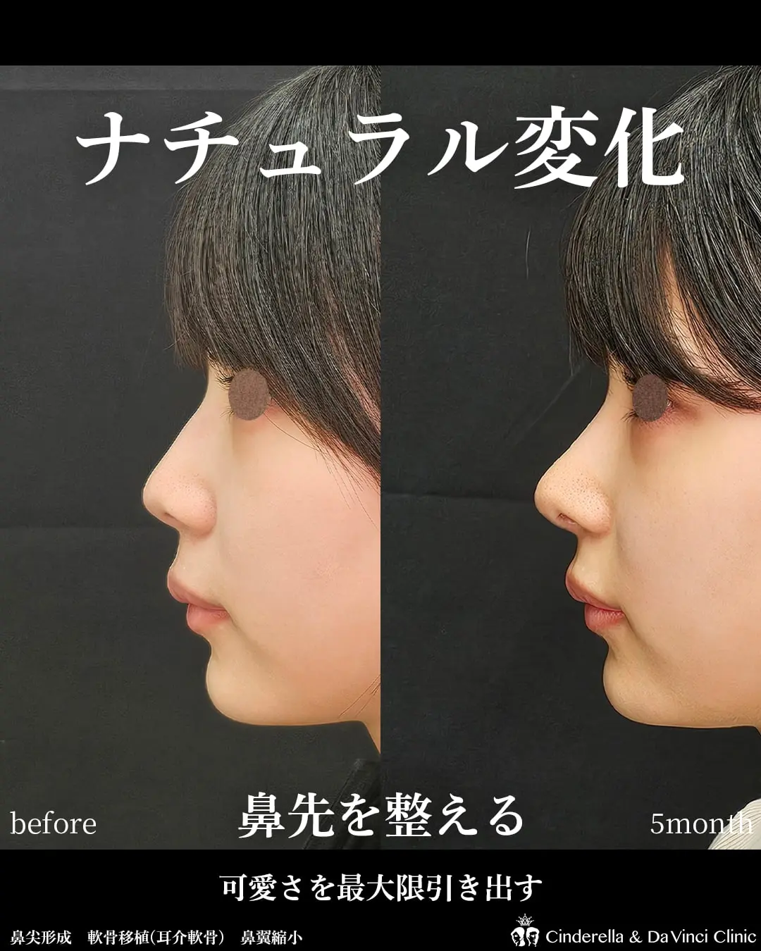 ナチュラル変化