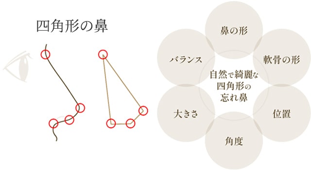 四角形の忘れ鼻