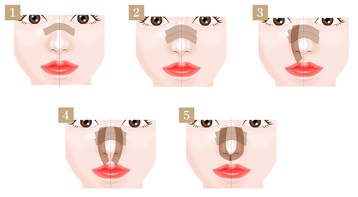 鼻尖形成の画像