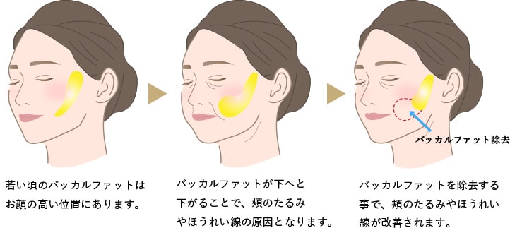 認定された形成外科医を見つけるにはどうすればよいですか?