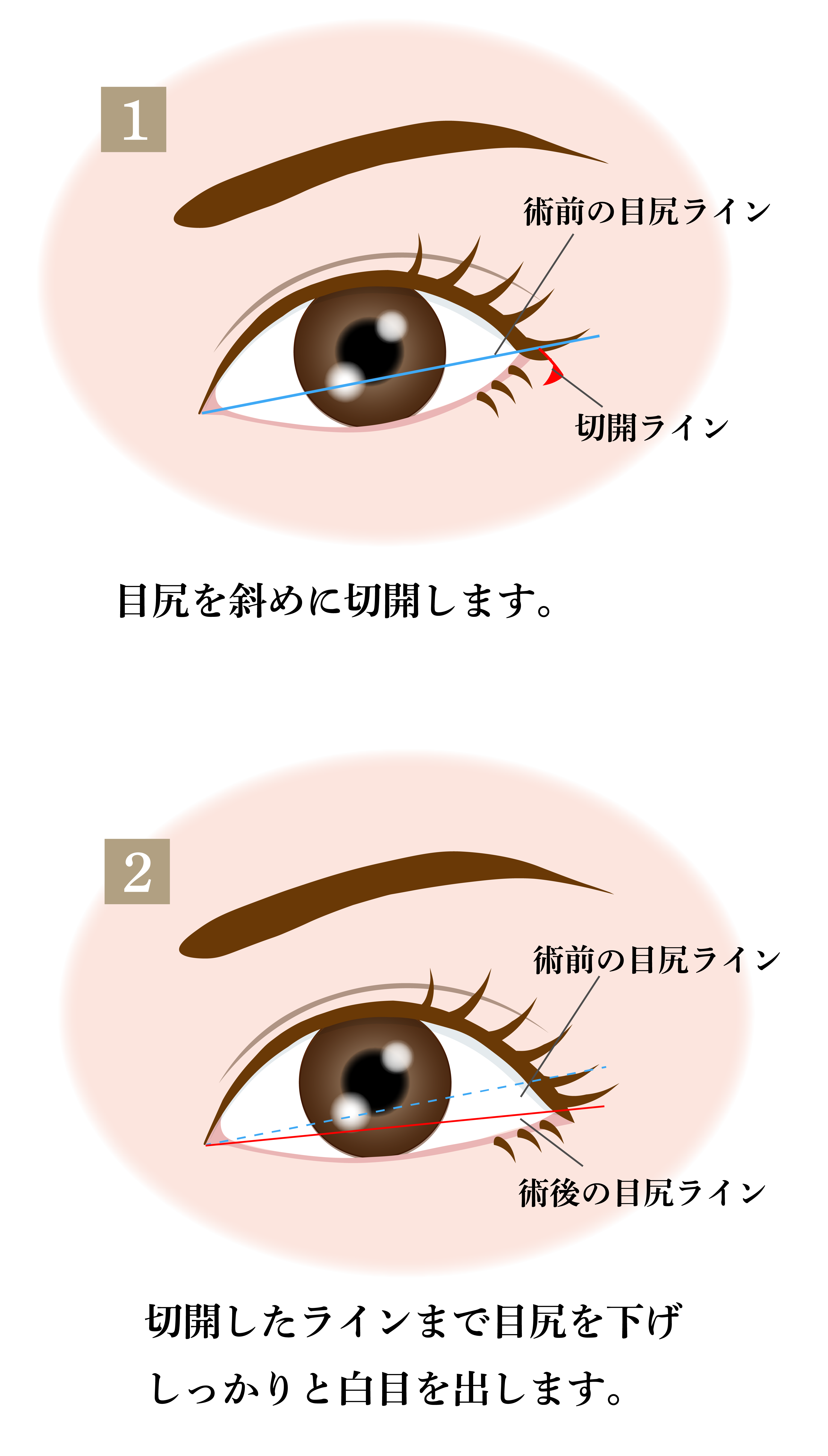 目元切開 目元の美容整形 名古屋の美容外科 Cinderella Da Vinci Clinic 公式