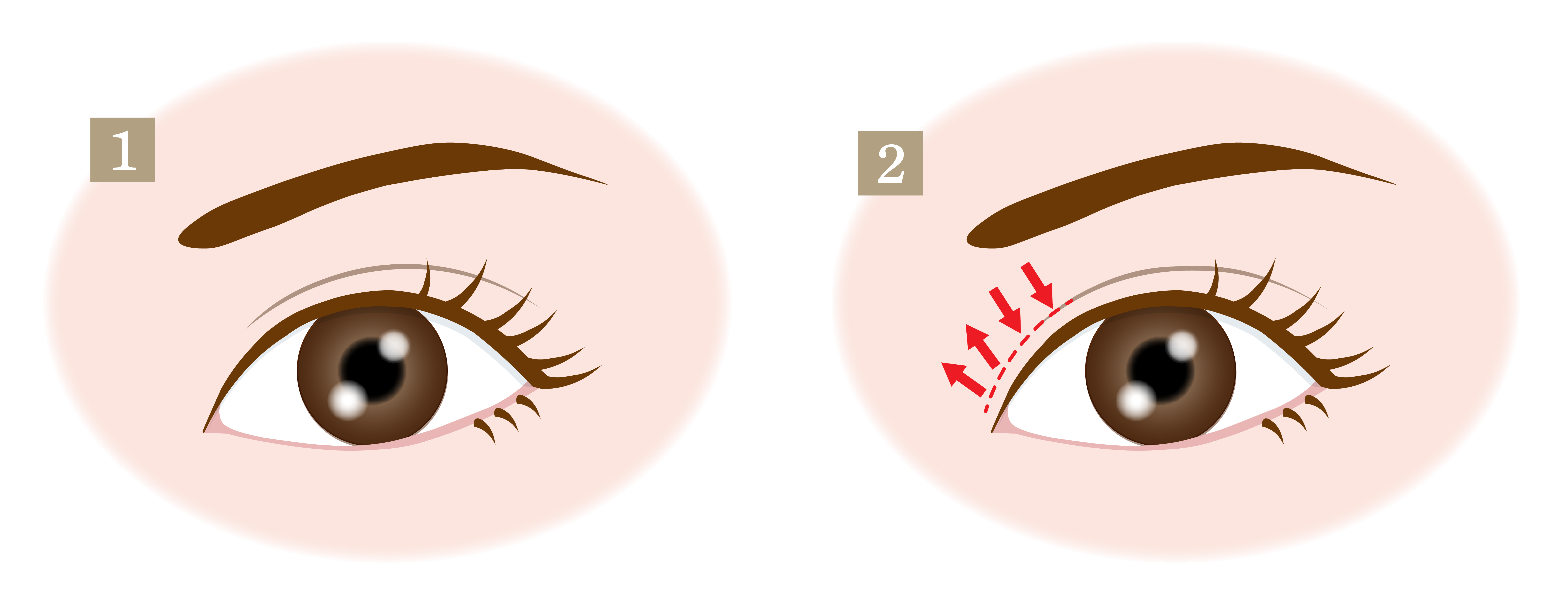 目元切開 目元の美容整形 名古屋の美容外科 Cinderella Da Vinci Clinic 公式