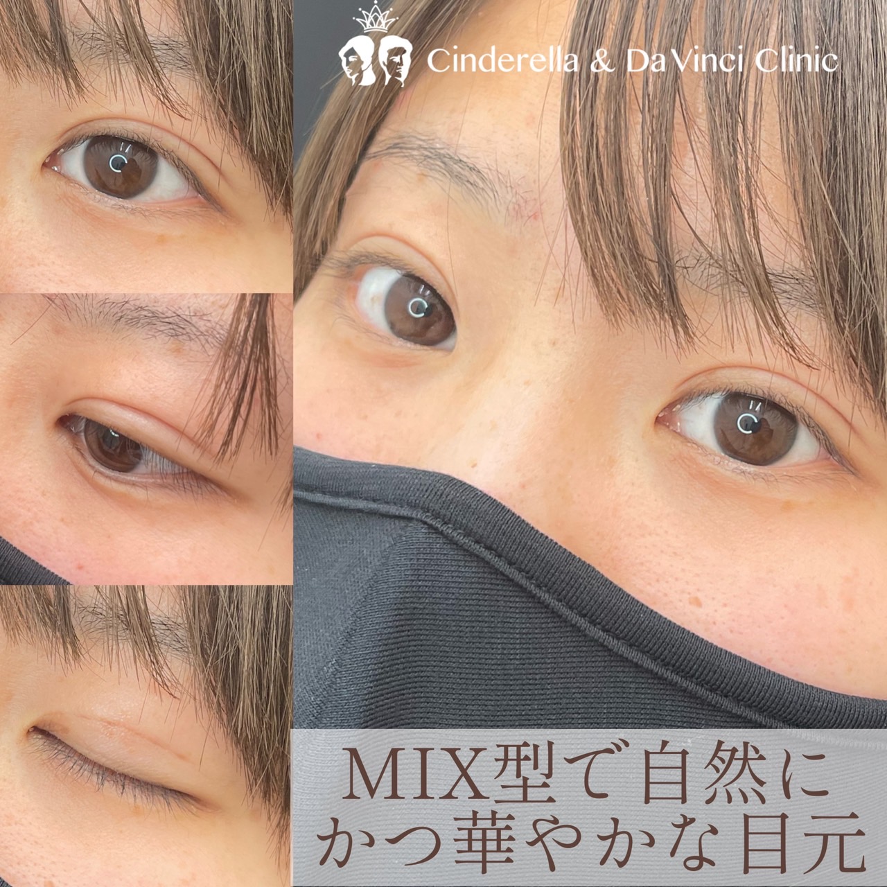 MIX型で自然に、かつ華やかな目元の画像