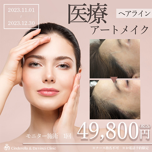 ヘアラインアートメイクの画像