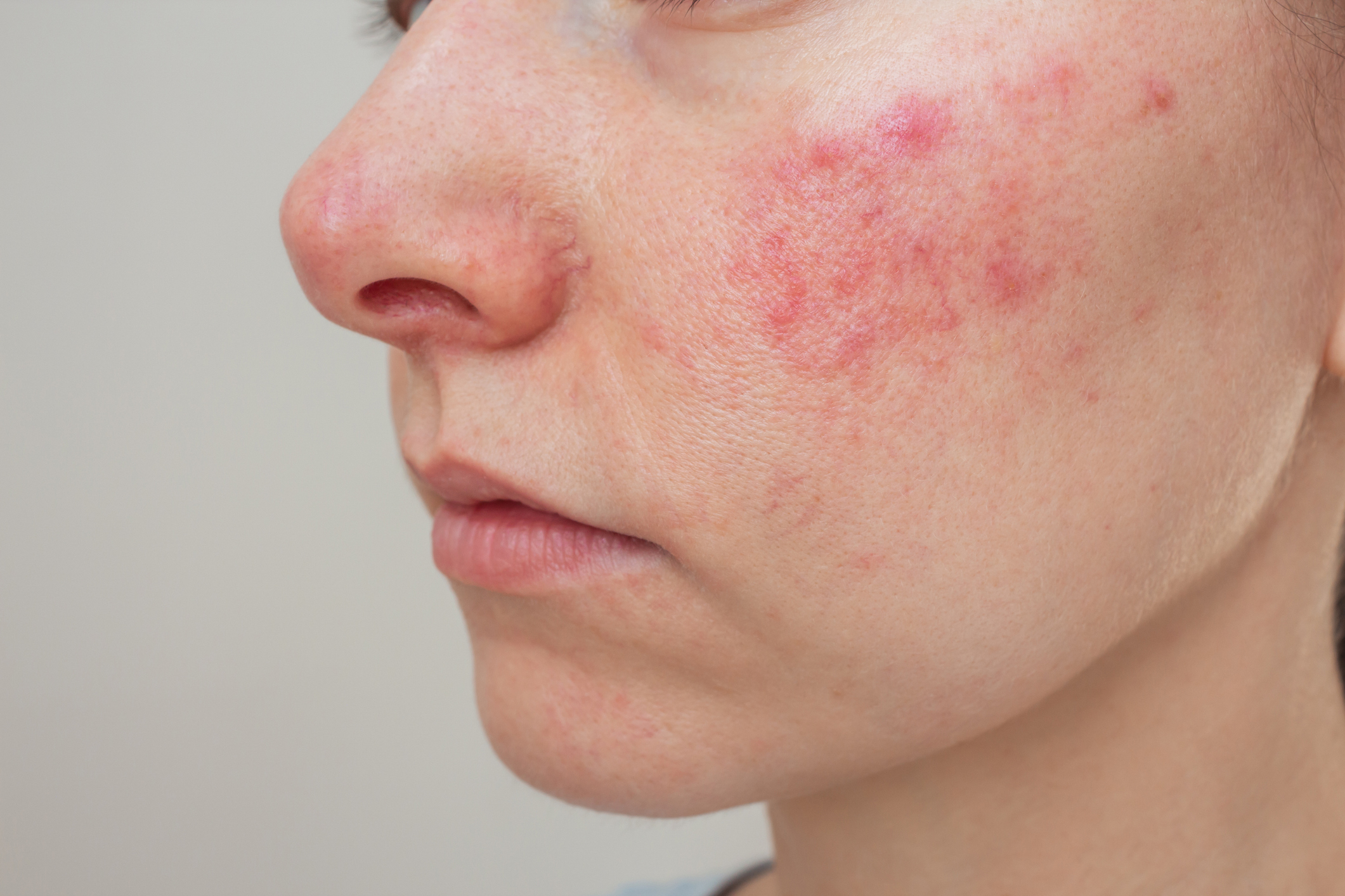 iStock-1601372894.jpg