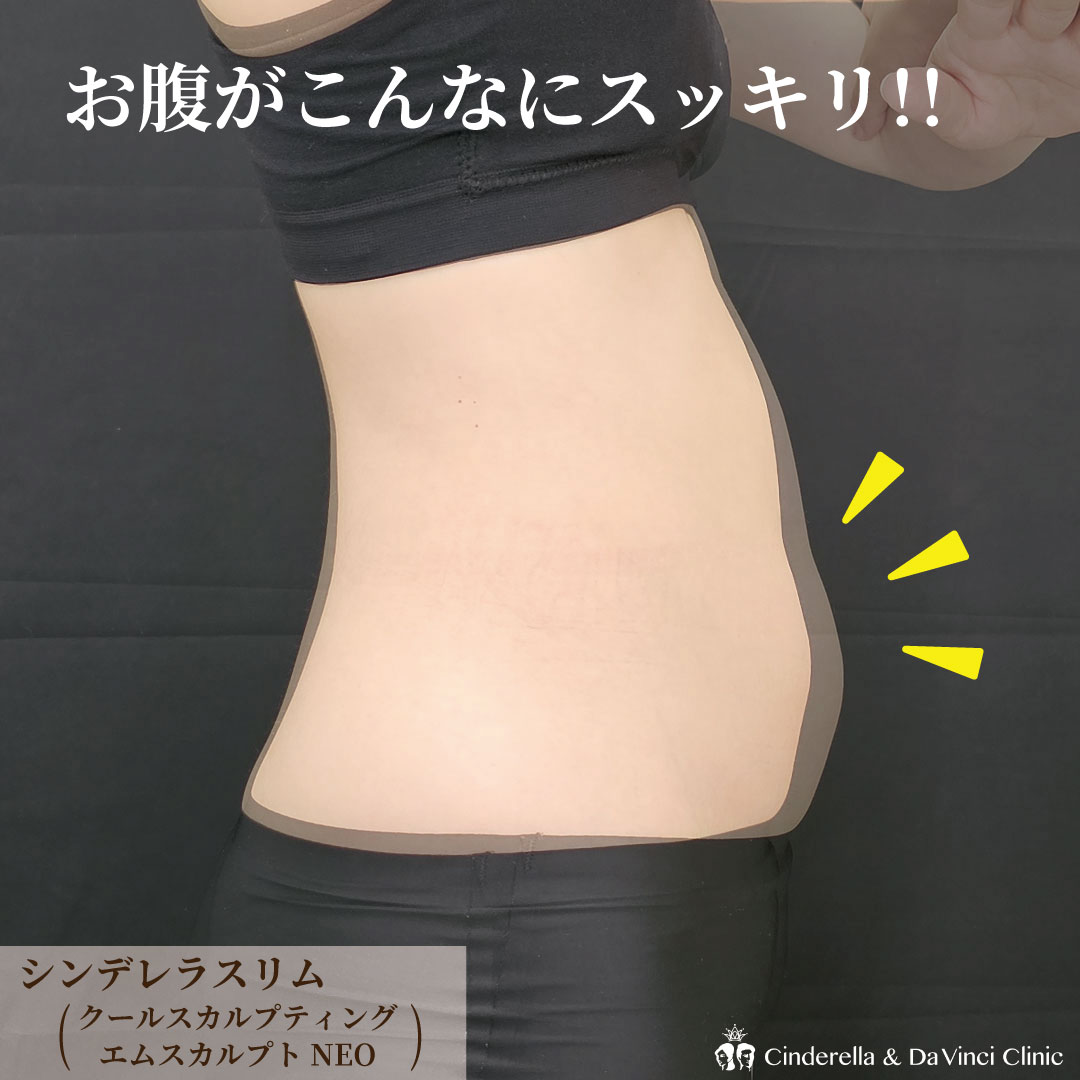 筋肉をつけながら脂肪を減らすの画像