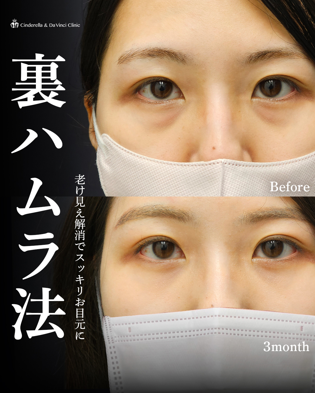 裏ハムラで老け見え卒業の画像