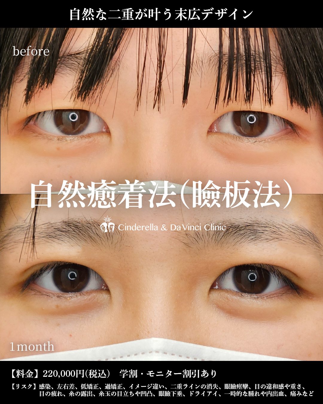 末広デザインでナチュラル二重の画像