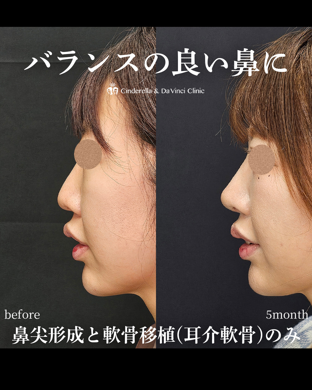 バランスの良い鼻の画像