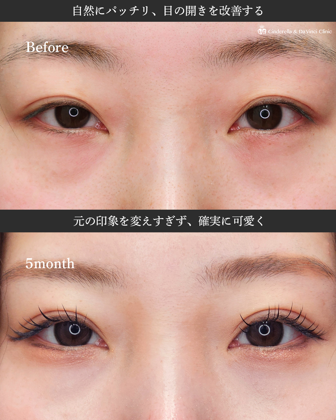 自然にパッチリお目元の画像