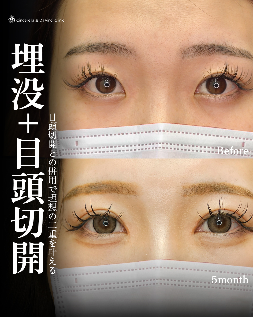 綺麗なアーモンドアイの画像