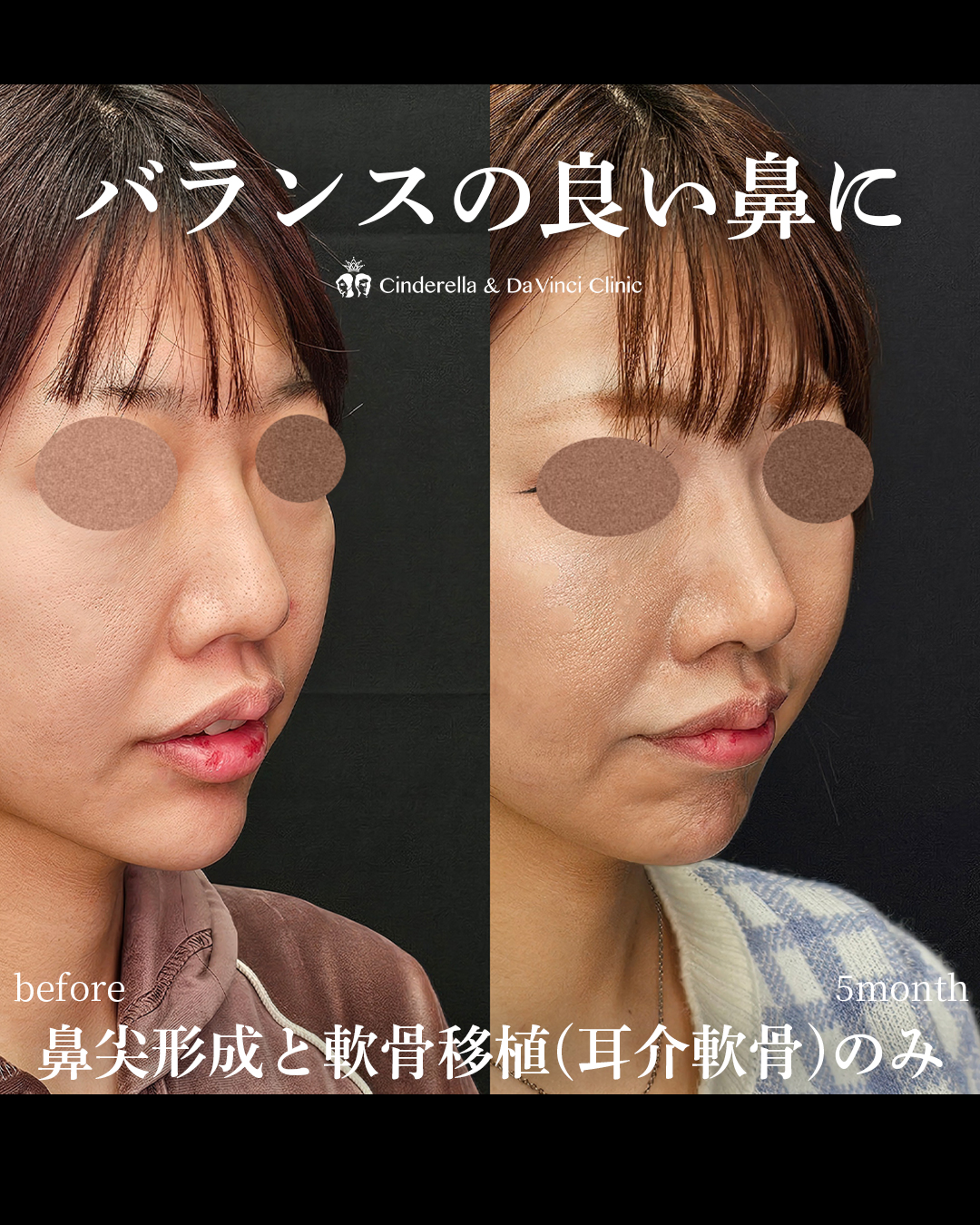バランスの良い鼻の画像