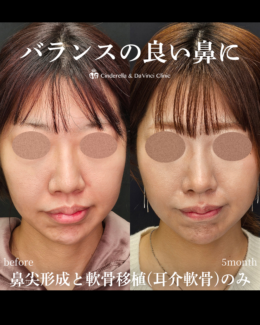 バランスの良い鼻の画像
