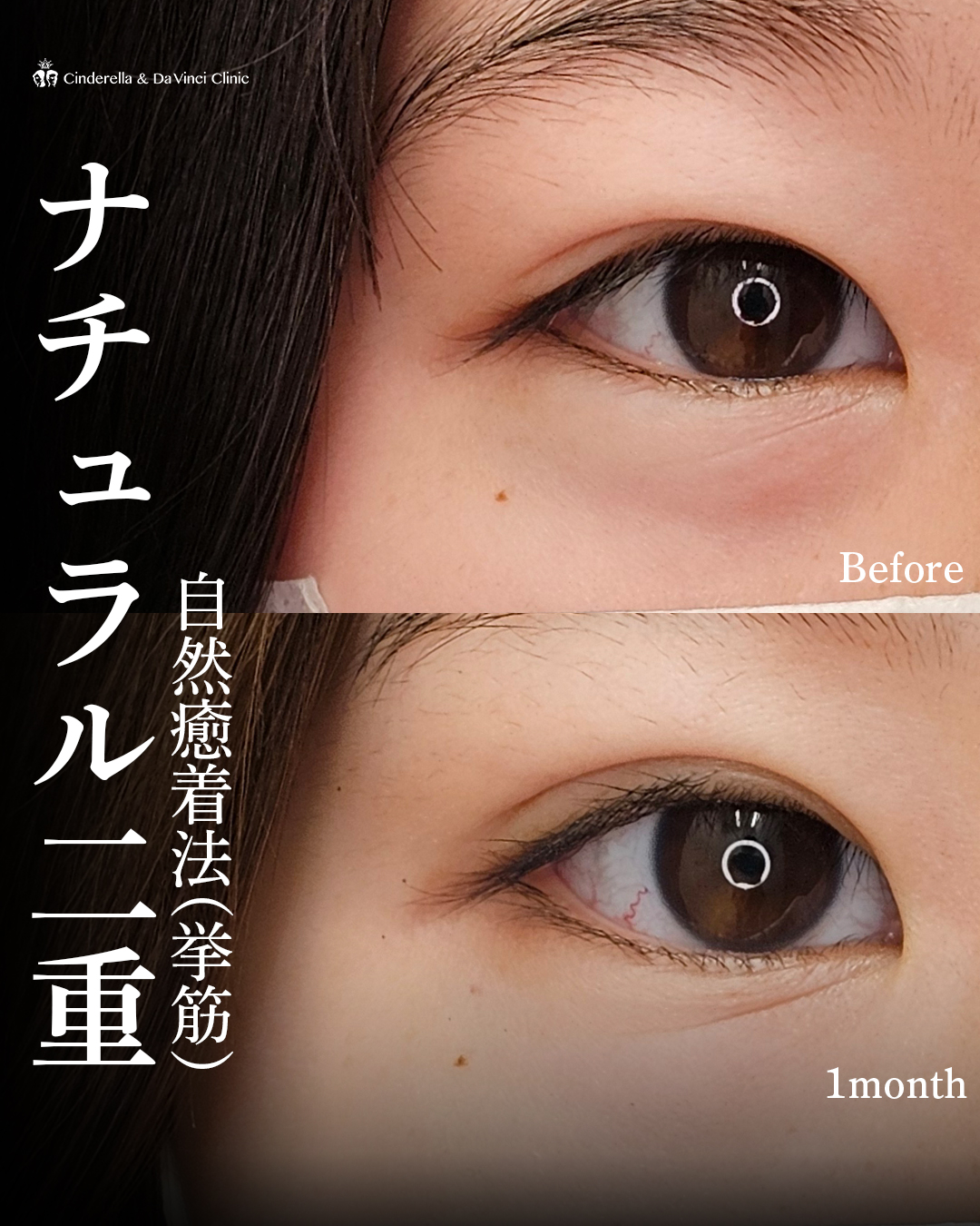 ナチュラルな二重の画像