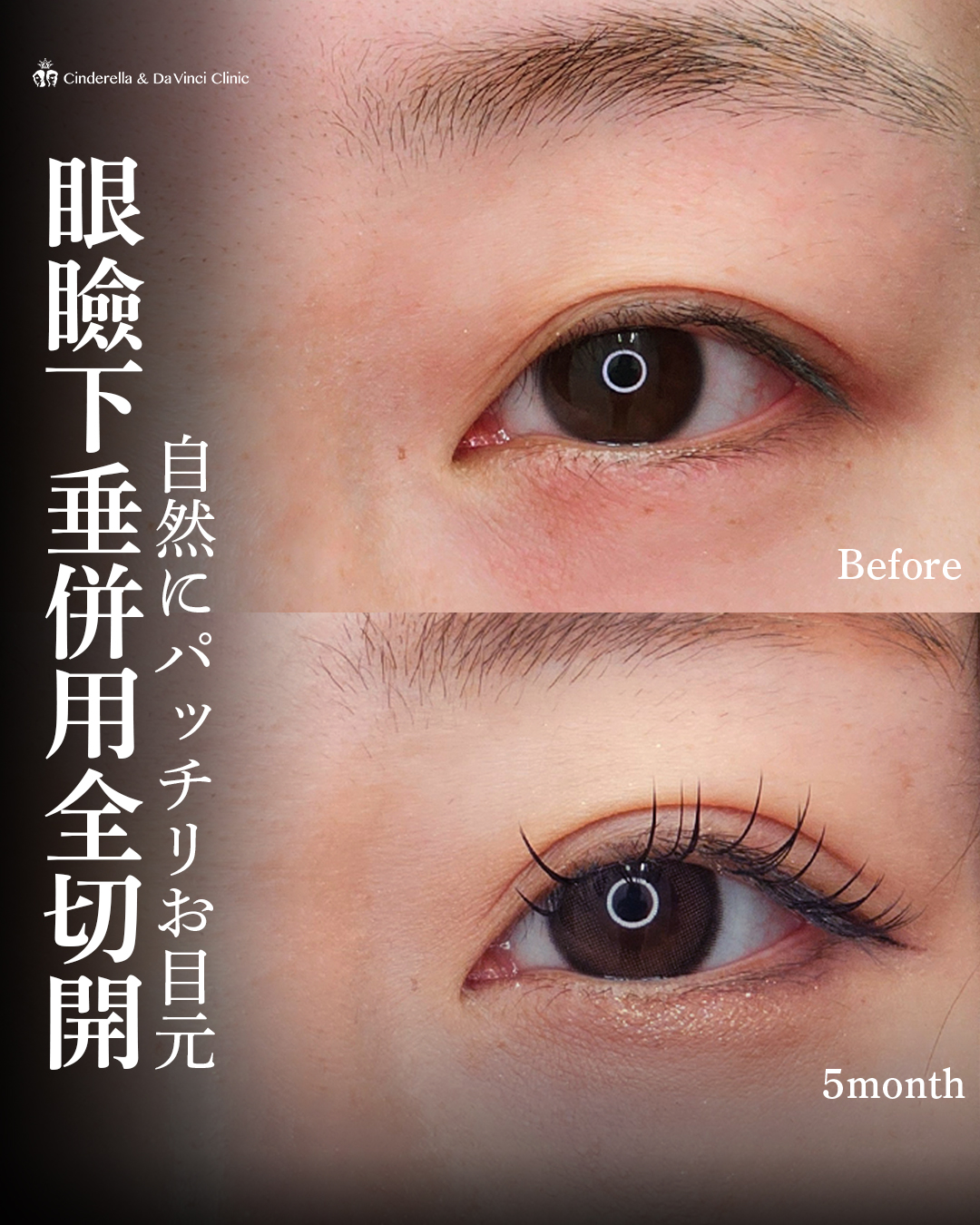 自然にパッチリお目元の画像