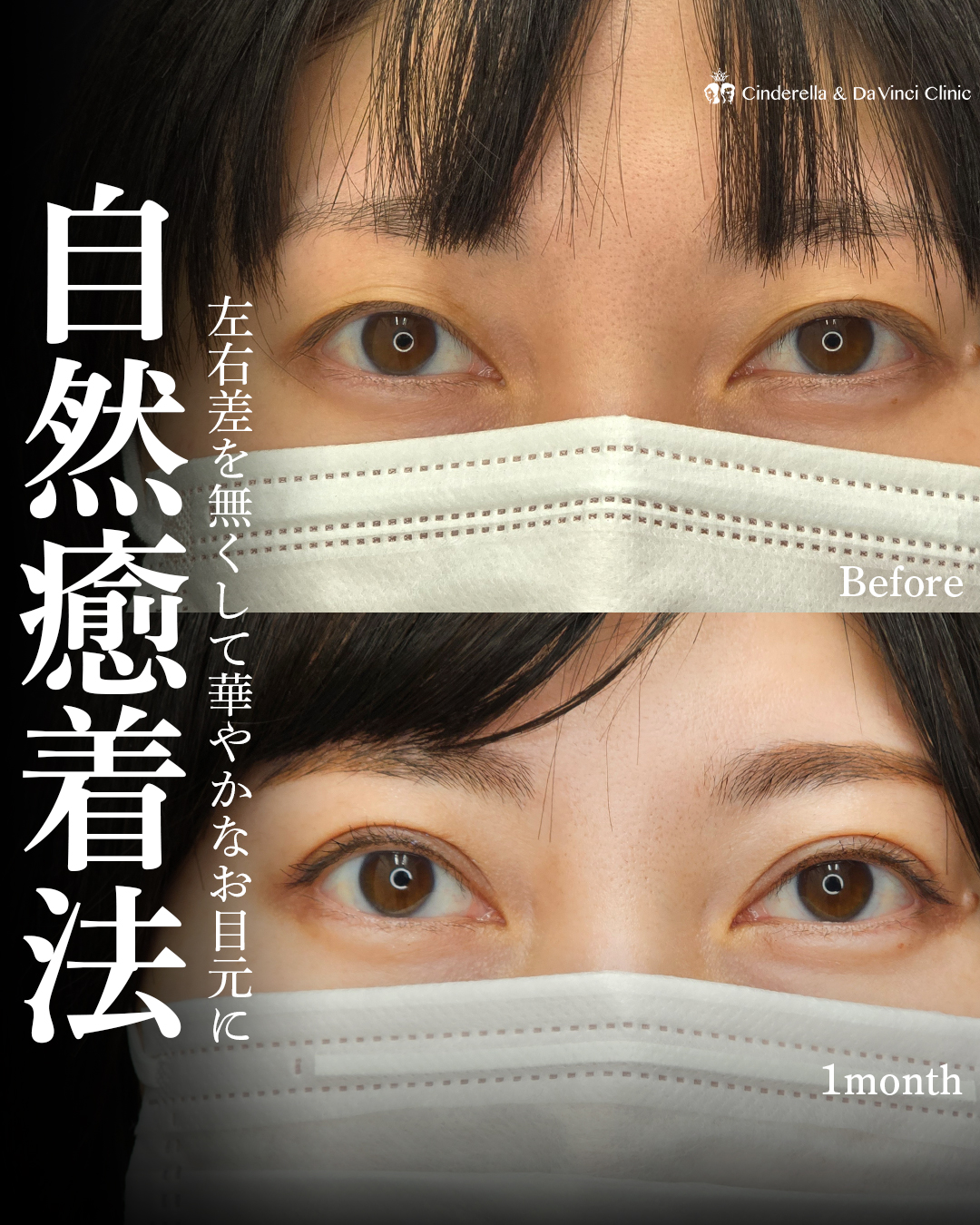 左右差を無くして華やかなお目元にの画像