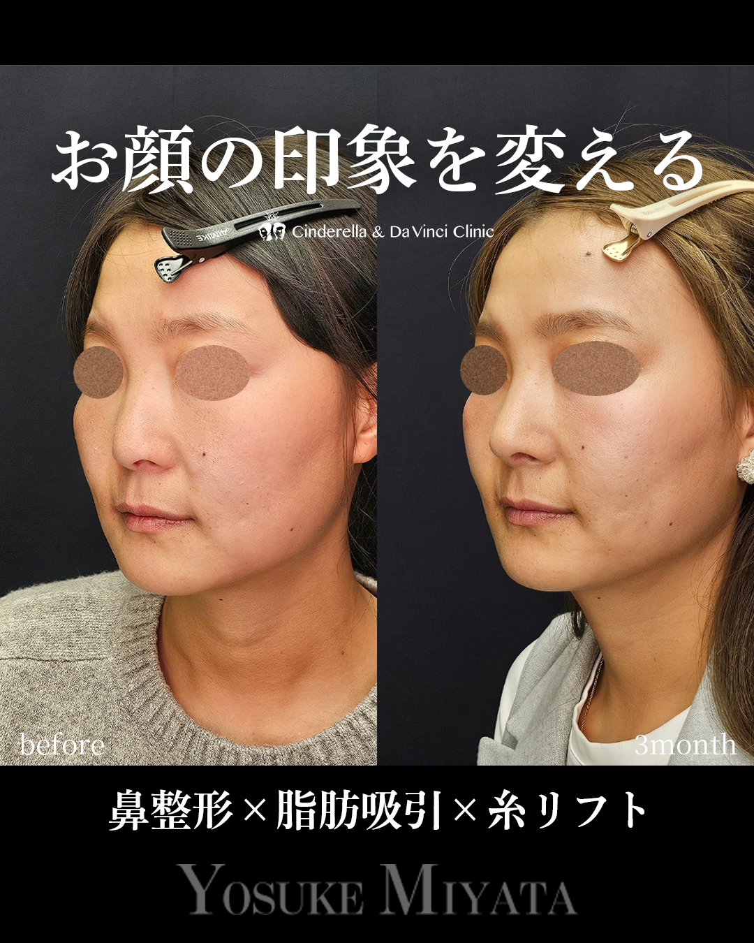 お顔の印象を変えるの画像