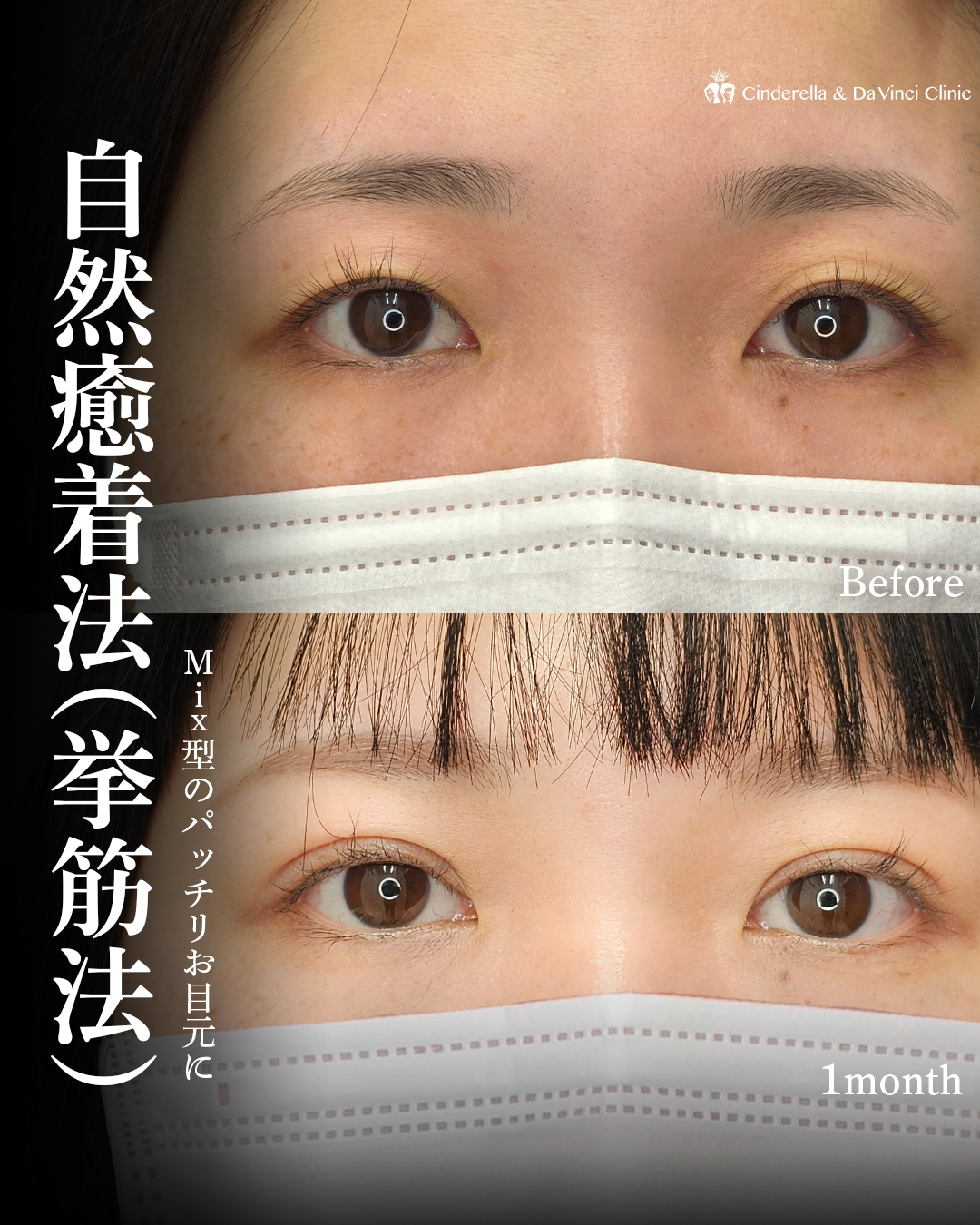 Mix型のパッチリお目元で可愛くの画像