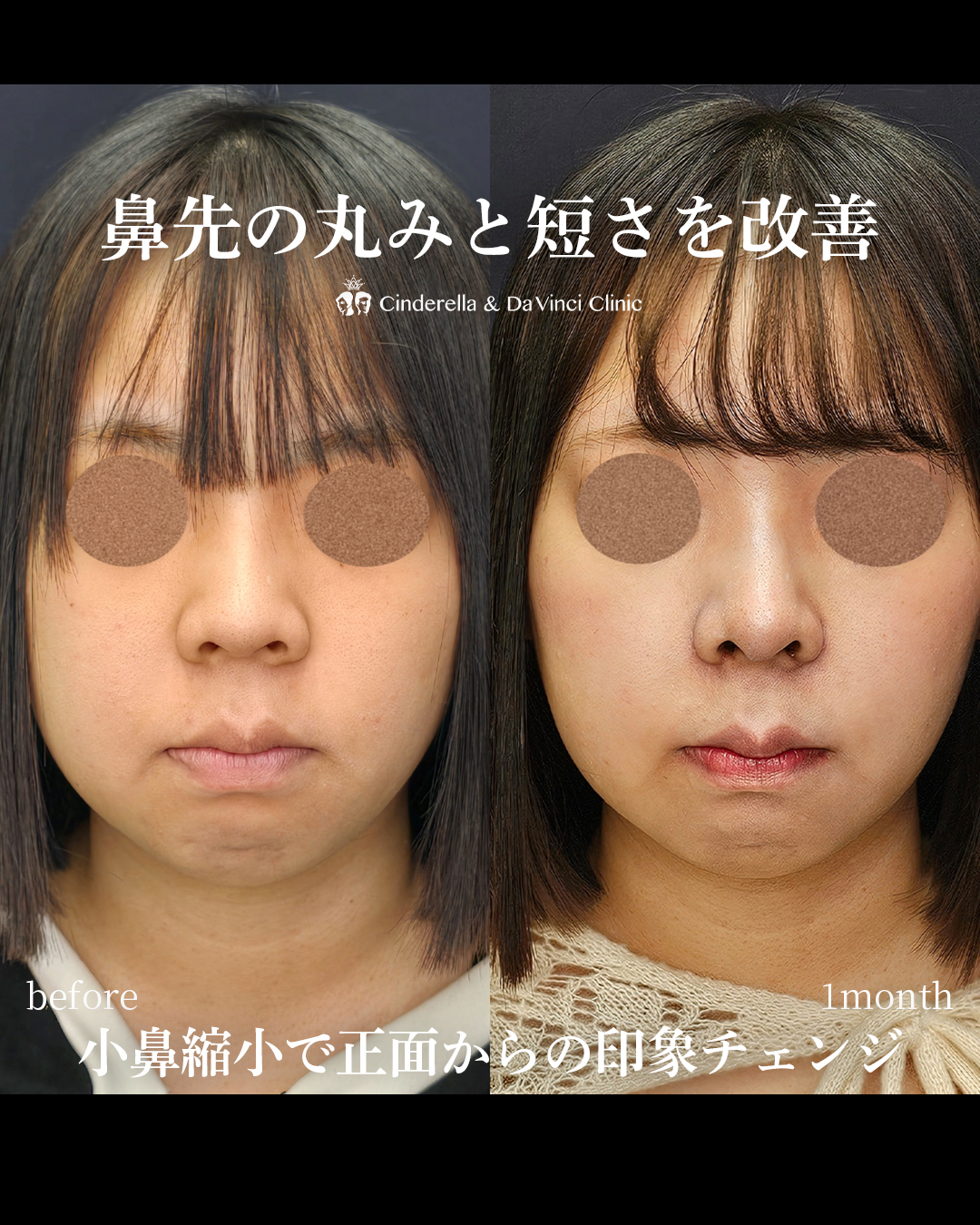 鼻先の丸みと短さ改善の画像