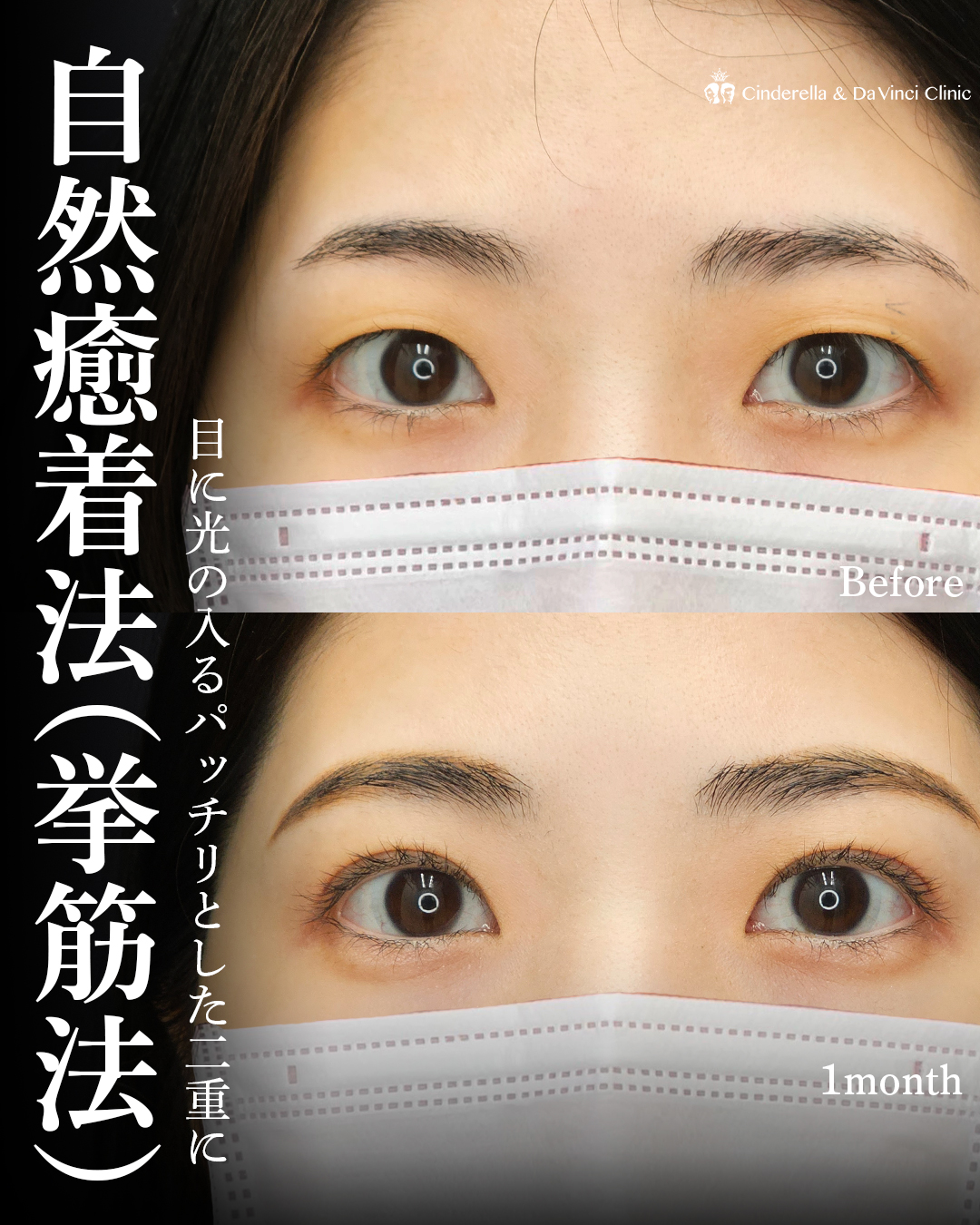 写真映えする綺麗な二重の画像