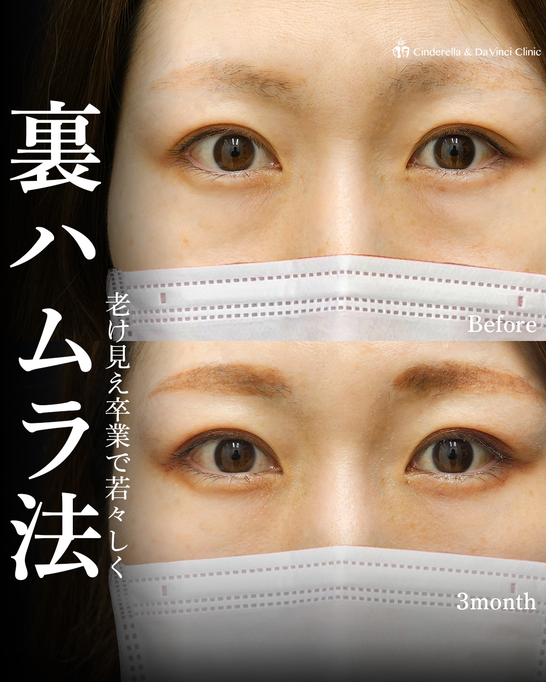 自然な若返りを叶えるの画像