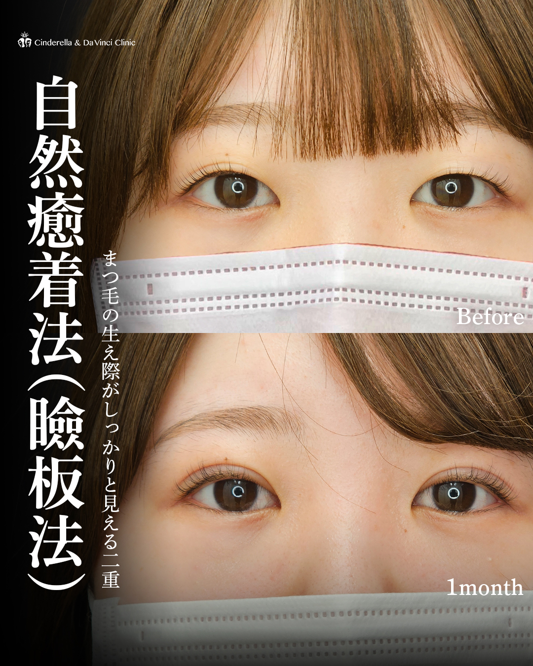 まつ毛の生え際見せで可愛い二重の画像