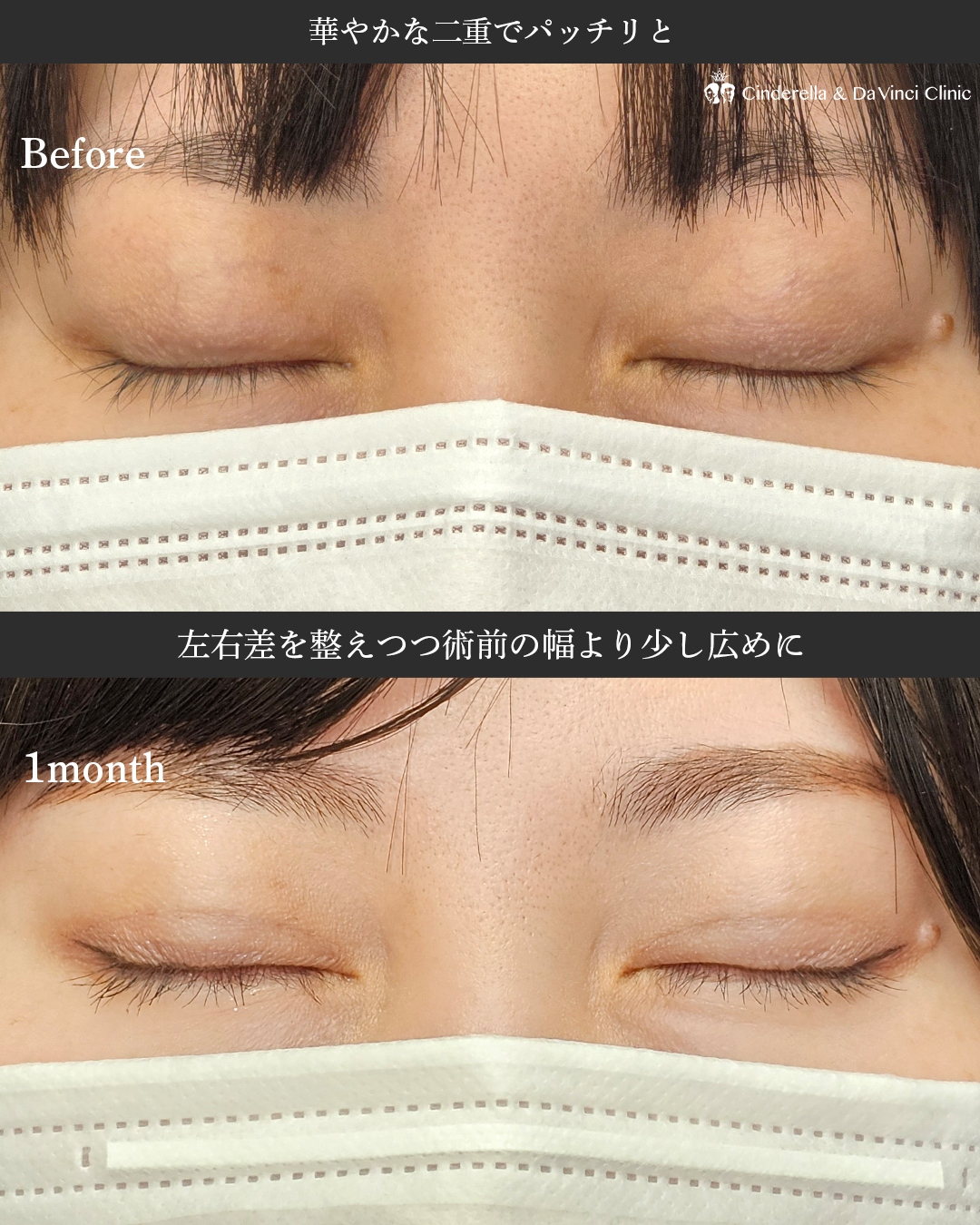 左右差を無くして華やかなお目元にの画像
