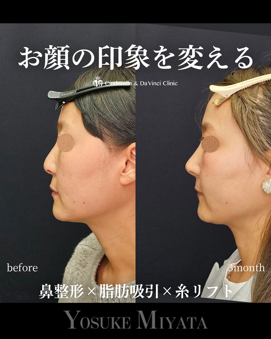 お顔の印象を変えるの画像