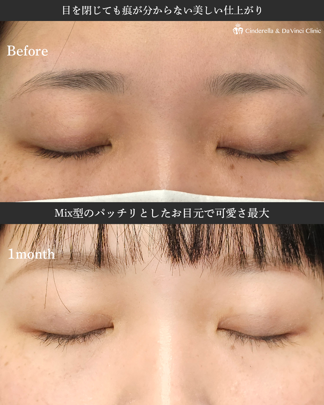 Mix型のパッチリお目元で可愛くの画像