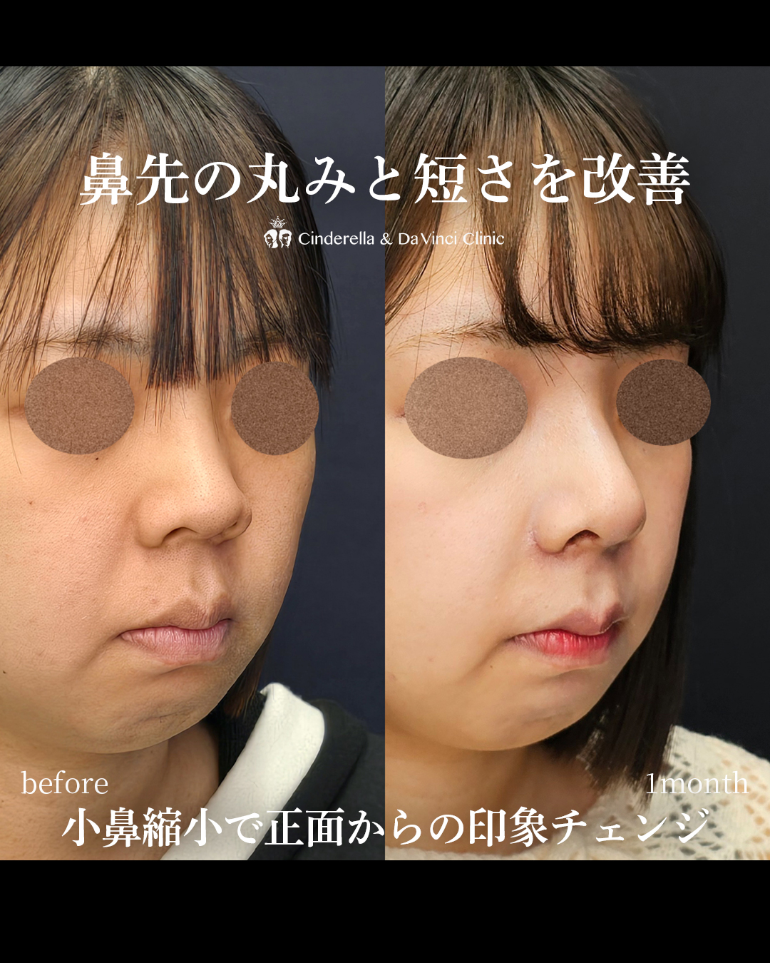 鼻先の丸みと短さ改善の画像