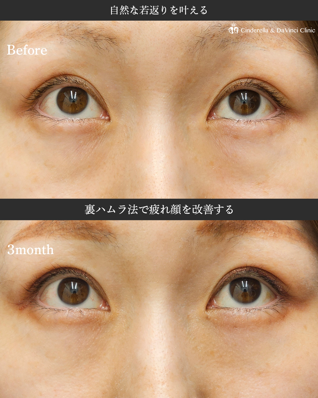 自然な若返りを叶えるの画像