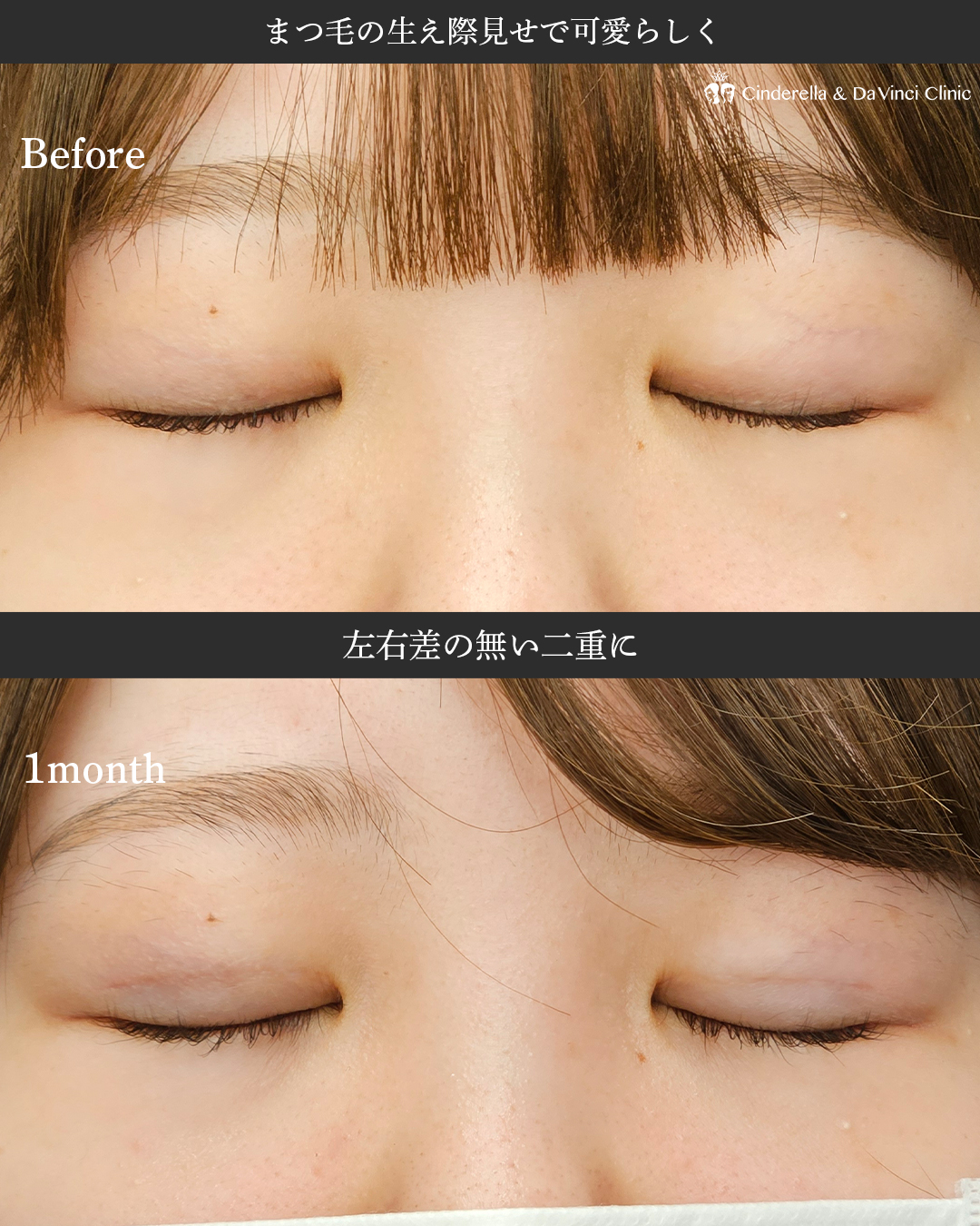まつ毛の生え際見せで可愛い二重の画像