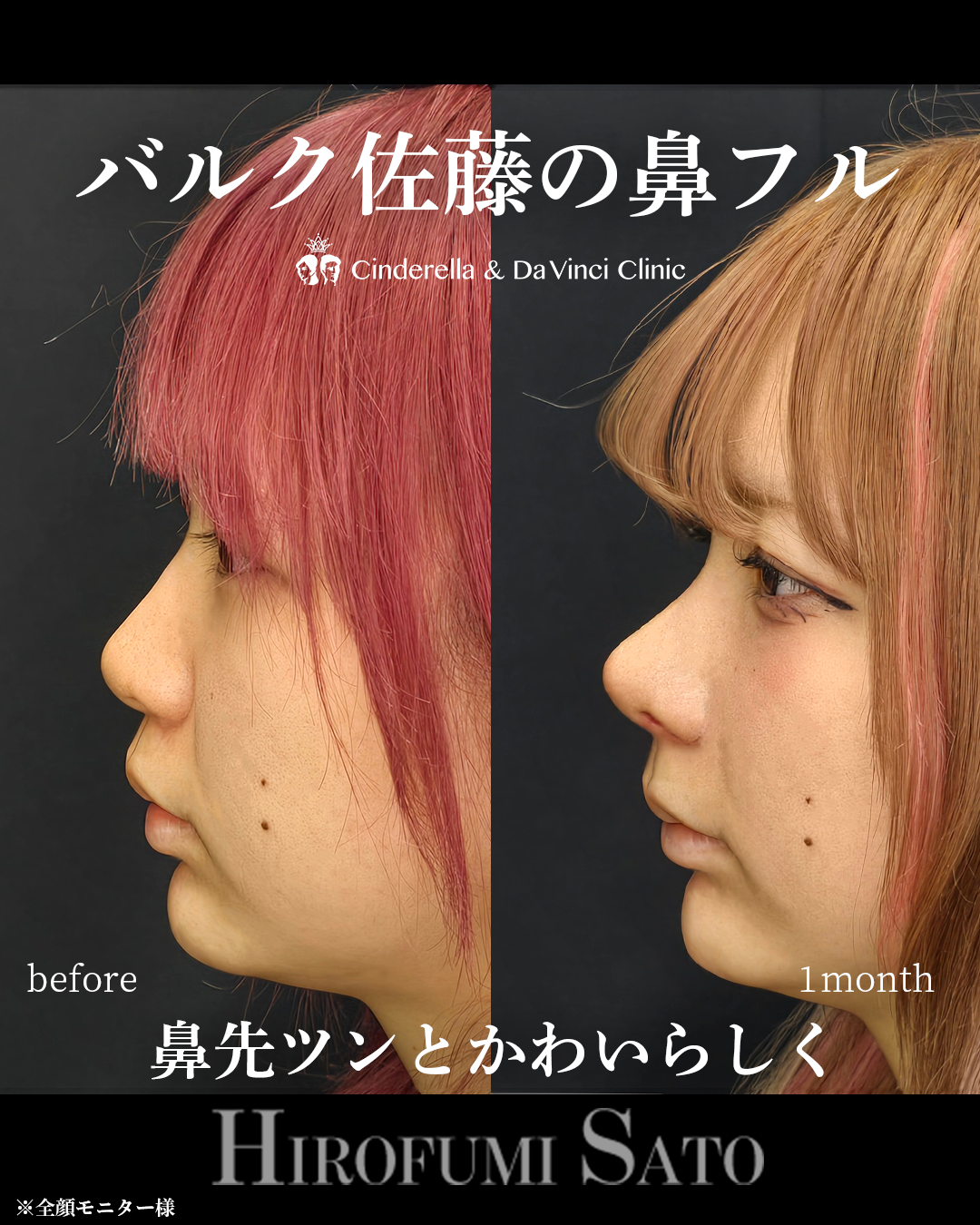 人形のようなツンと高いお鼻の画像