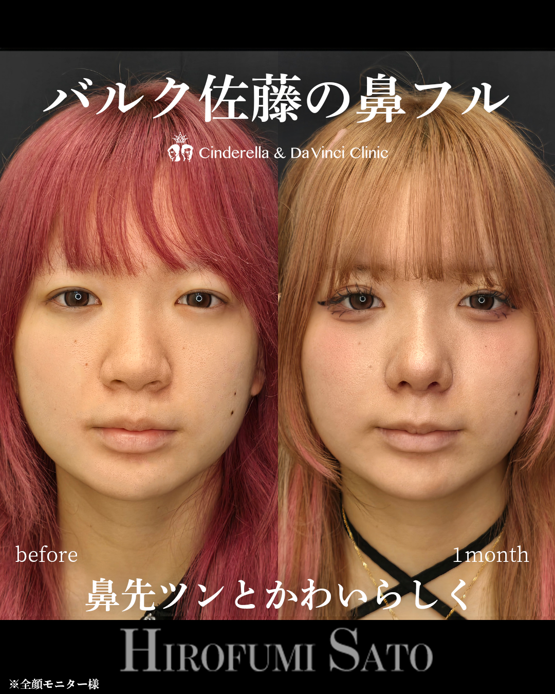 人形のようなツンと高いお鼻の画像