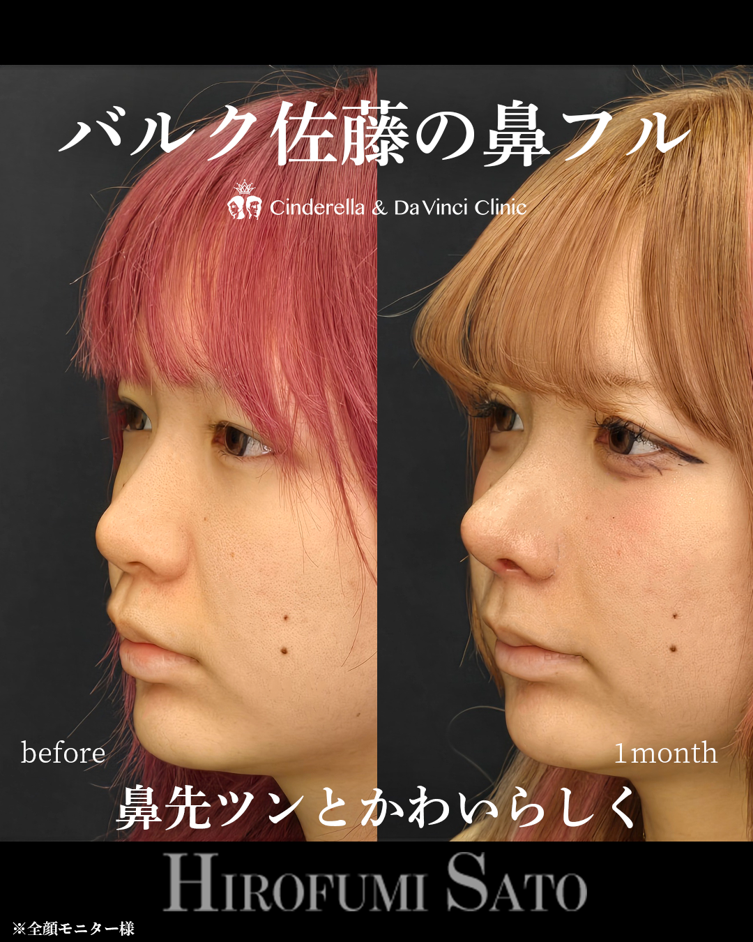 人形のようなツンと高いお鼻の画像