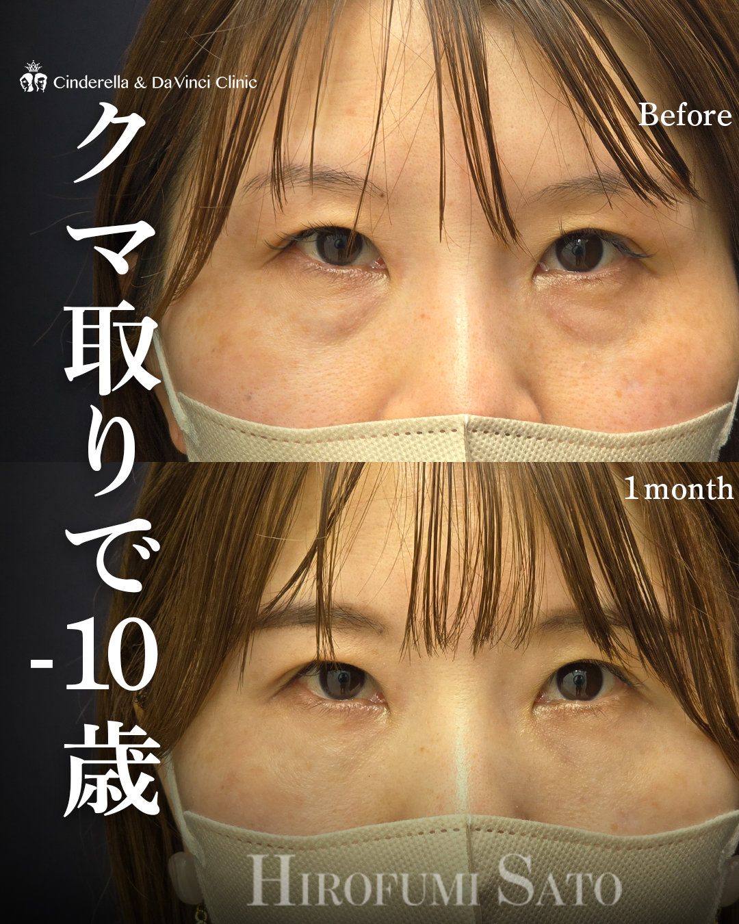 クマ取りで-10歳の画像