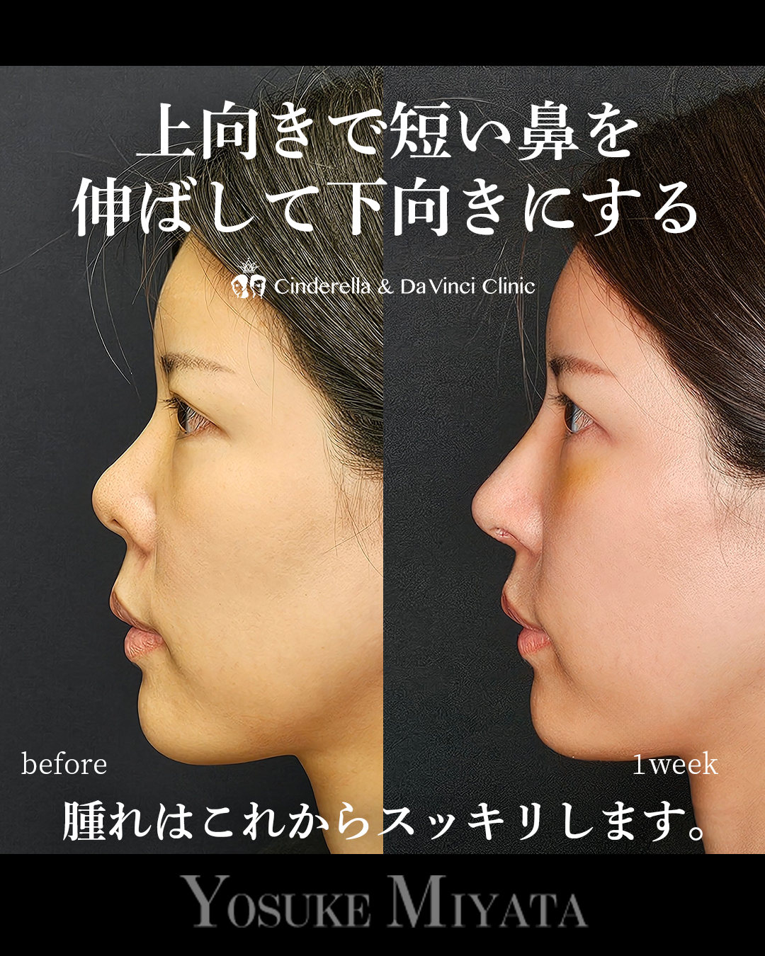 短い鼻を伸ばすの画像